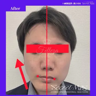 メンズ 有人型セルフサロン 脱毛/痩身/美顔のその他イメージ