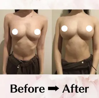 バスト・脱毛・痩身 上島のエステ・リラクイメージ