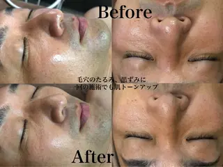 六本木脱毛andS 店長Sachiのエステ・リラクイメージ