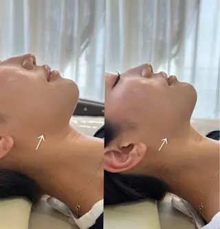 Amaranth所属・Lupinus 小顔矯正のエステ・リラクイメージ