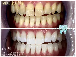 札幌ホワイトニング ラディアンス札幌駅店のその他イメージ