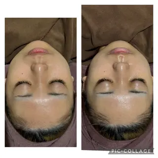 ニキビケア専門サロン Unityのエステ・リラクイメージ