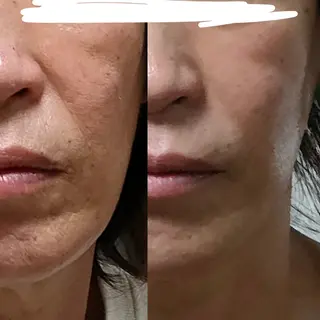 女性専用 フェイシャルサロン新小岩　シエスタ所属・女性専用フェイシャル シエスタのエステ・リラクイメージ