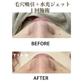 美肌サロンTIAM by tetoteのエステ・リラクイメージ