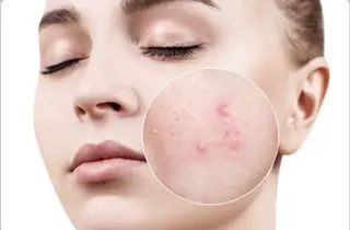 Belle 天王寺店所属・韓国肌管理Belle 天王寺のエステ・リラクイメージ