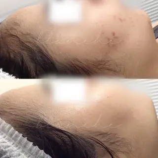 セミロング カラー パーマ ヘアアレンジ ネイル マツエク・マツパ アイブロウ 都度払い肌質改善 &脱毛Blancheのエステ・リラクイメージ