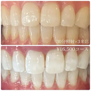 PLATINUM Beauty 横浜店所属・ホワイトニングルーム 横浜店のその他イメージ