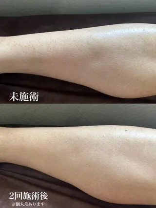 メンズ muumo所属・muumo まりののエステ・リラクイメージ