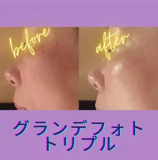 ラブニール 恵比寿店のエステ・リラクイメージ