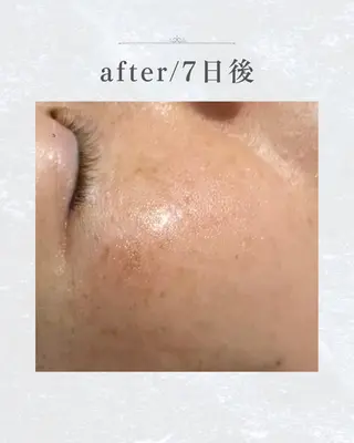 なにわのシミ取り職人 YUKIのエステ・リラクイメージ