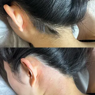 六本木脱毛andS 店長Sachiのエステ・リラクイメージ