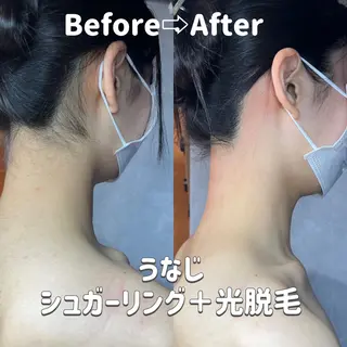 うなじラボ(UNAJI LABO)所属・池袋脱毛 さとうのエステ・リラクイメージ