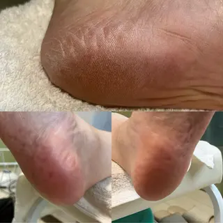 ネイル SHIKI モリンガ蒸し/水光肌のエステ・リラクイメージ