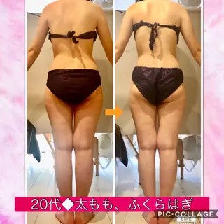 ショート カラー パーマ ヘアアレンジ メンズ キッズ ネイル マツエク・マツパ ‍痩身＆ボディ 結果出し🌟丹野のエステ・リラクイメージ