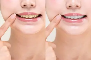 MBEAUTYSALON 千葉店・京成大久保所属・Melty 輝のその他イメージ