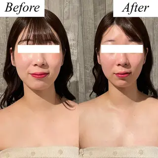 グレースフィオーレ上野御徒町店所属・頭蓋骨小顔矯正 上野御徒町店*かんなのエステ・リラクイメージ