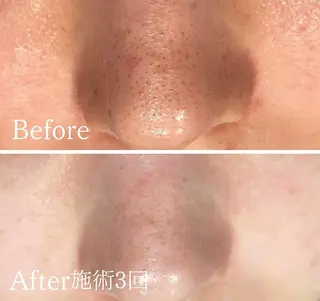 アンド ミルルのエステ・リラクイメージ