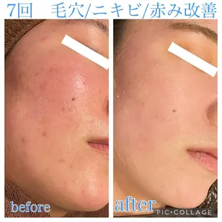 ミディアム カラー パーマ ヘアアレンジ メンズ キッズ ネイル マツエク・マツパ Ensor Clair所属・EnsorClair 代表　野口真央のエステ・リラクイメージ