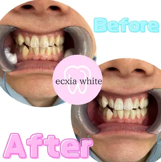 エクシア　ホワイト　宇治小倉店所属・大森 愛來のその他イメージ