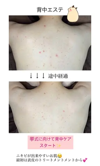 ベラージュ【美背中・ 美尻・フェイシャル】のエステ・リラクイメージ