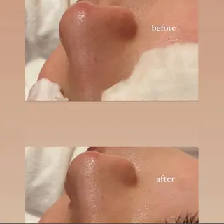 reve .のエステ・リラクイメージ