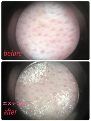 メナードフェイシャルサロン岐阜桜通所属・大橋 あつこのエステ・リラクイメージ