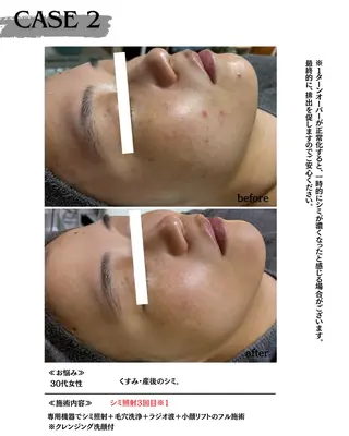 素肌育成・シミケア専門サロン美潤-miulu-所属・【医療提携サロン】 【シミケア専門】のエステ・リラクイメージ