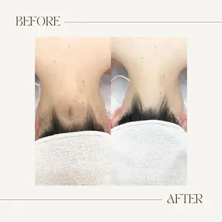 脱毛専門サロンELIXIR（ｴﾘｸｻｰ）所属・脱毛&ホワイトニング ELIXIR×ULTのエステ・リラクイメージ