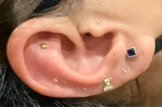 LiZA エステティックサロンのエステ・リラクイメージ