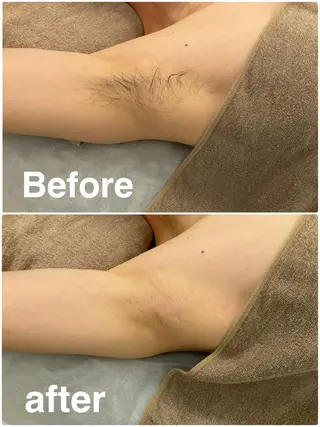 beauty salon RePi所属・B.S. RePiのエステ・リラクイメージ