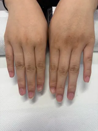 ネイル 楠本 琴音のネイルデザイン