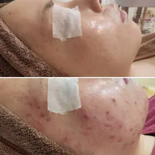 Anacia Beauty Salon所属・美肌脱毛&毛穴専門 Anaciaのエステ・リラクイメージ