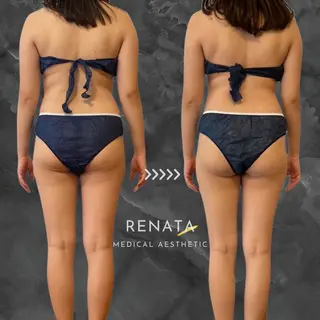 RENATA🕊 脂肪冷却専門店六本木のエステ・リラクイメージ