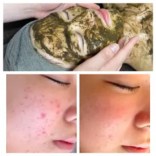 肌質改善エステ chiffonのエステ・リラクイメージ