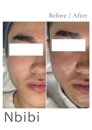 韓国🇰🇷価格 サロン_Nbibiのエステ・リラクイメージ