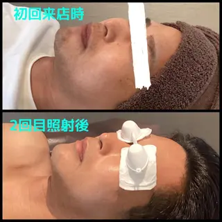 メンズ メンズ脱毛ECXIA所属・men's脱毛サロン ECXIAのエステ・リラクイメージ