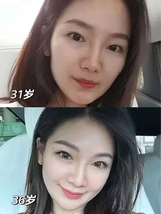 ネイル aliaハイフ&水光ジェットサロン所属・aliaハーブ水光店 エステティシャン募集のエステ・リラクイメージ