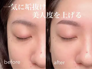 アイブロウ and MORE アンドモア(代々木)のマツエク・マツパデザイン