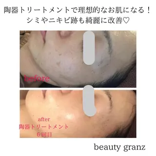 痩身専門サロン ビューティーグランツのエステ・リラクイメージ