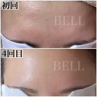 BEAUTY SALON BeLL所属・毛穴ケア専門店 BeLL ベルのエステ・リラクイメージ