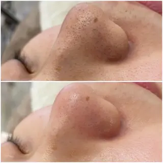 ララ/ハーブ メゾンリュバンのエステ・リラクイメージ