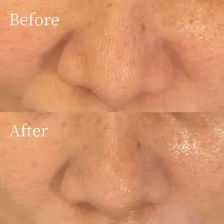 【肌質ケアサロン】 RUMINIRのエステ・リラクイメージ