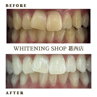 メンズ ホワイトニング ショップ葛西店のその他イメージ