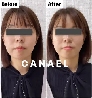頭蓋骨から小さくする小顔&ヘッドスパ専門店 CANAEL所属・頭蓋骨から小さくする 小顔&ヘッドスパ専門のエステ・リラクイメージ