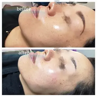 🅖🅤🅩🅔🅛 salonのエステ・リラクイメージ