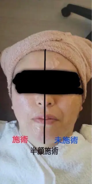 Beauty Salon Mirei所属・ﾋﾞｭｰﾃｨｰｻﾛﾝ Mirei 山下の眉毛・アイブロウイメージ