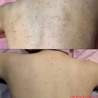 ハーブピーリング専門店プリンセスピーチ所属・ハーブピーリング脱毛 プリンセスピーチのエステ・リラクイメージ