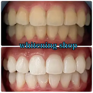 ホワイトニング ショップ吉祥寺店のエステ・リラクイメージ