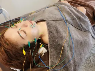 即効⚡小顔美容鍼🪡 むくみたるみ脂肪解消のエステ・リラクイメージ