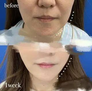 ショート aliaハイフ&水光ジェットサロン所属・aliaハーブ水光店 エステティシャン募集のエステ・リラクイメージ